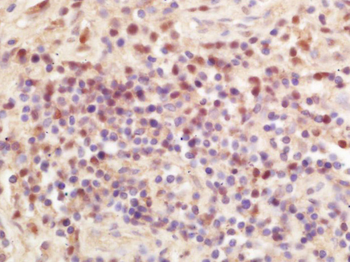 Phospho-KMT6 (Ser21) Rabbit Polyclonal Antibody