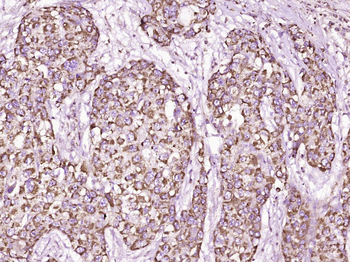 LAT Rabbit Polyclonal Antibody