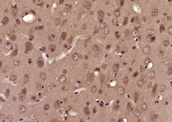 LAT Rabbit Polyclonal Antibody