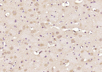 LC3B Rabbit Polyclonal Antibody