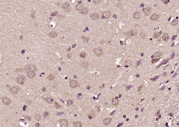 LGI3 Rabbit Polyclonal Antibody