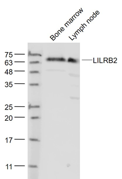 LILRB2 Rabbit Polyclonal Antibody
