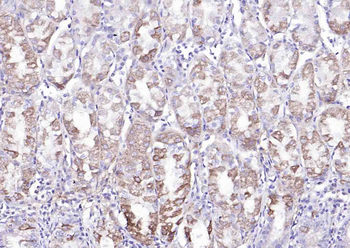 LIM kinase 1 + 2 Rabbit Polyclonal Antibody