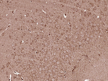 LIM kinase 1 + 2 Rabbit Polyclonal Antibody