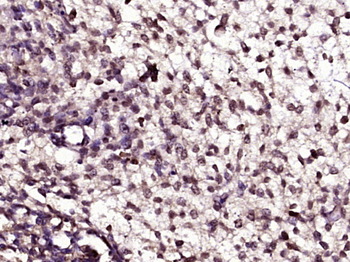 LIM kinase 1 + 2 Rabbit Polyclonal Antibody