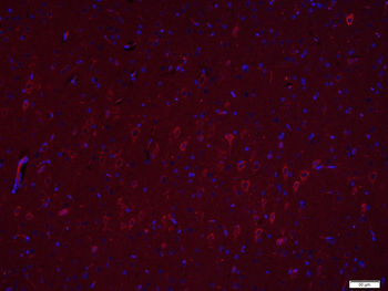 LIM kinase 1 + 2 Rabbit Polyclonal Antibody
