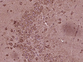 LIM kinase 1 + 2 Rabbit Polyclonal Antibody
