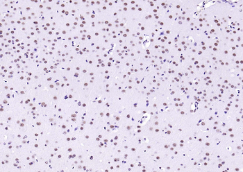 LMX1b Rabbit Polyclonal Antibody