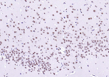 LMX1b Rabbit Polyclonal Antibody