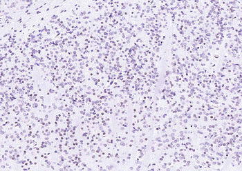 LMX1b Rabbit Polyclonal Antibody