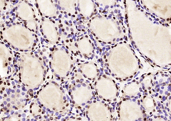 LMX1b Rabbit Polyclonal Antibody