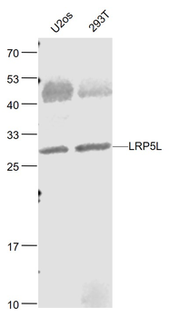 LRP5L Rabbit Polyclonal Antibody