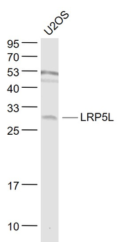 LRP5L Rabbit Polyclonal Antibody