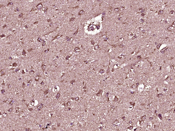 Monoamine Oxidase B Rabbit Polyclonal Antibody