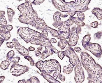 Monoamine Oxidase B Rabbit Polyclonal Antibody