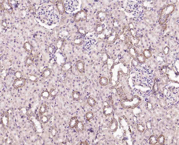 Monoamine Oxidase B Rabbit Polyclonal Antibody