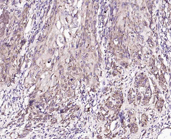 Monoamine Oxidase B Rabbit Polyclonal Antibody