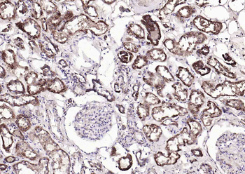 Monoamine Oxidase B Rabbit Polyclonal Antibody