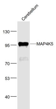 MAP4K5 Rabbit Polyclonal Antibody