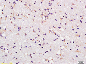 MCT1 Rabbit Polyclonal Antibody