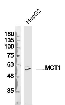 MCT1 Rabbit Polyclonal Antibody