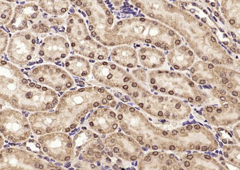 Meis homeobox 3 Rabbit Polyclonal Antibody