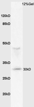 MHC Class II Rabbit Polyclonal Antibody