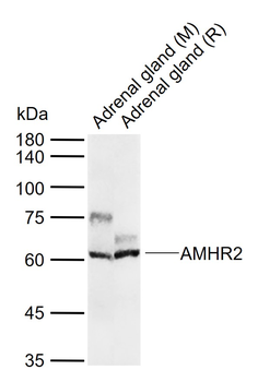 AMHR2 Rabbit Polyclonal Antibody
