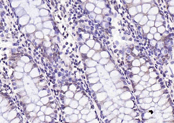 Mst2 Rabbit Polyclonal Antibody