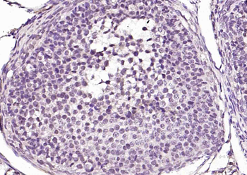 Mst2 Rabbit Polyclonal Antibody