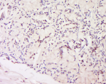 Mst2 Rabbit Polyclonal Antibody