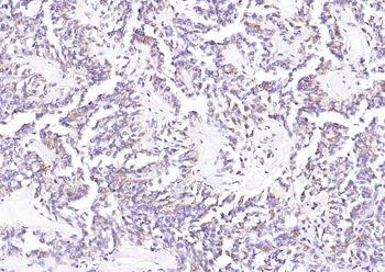 MUC5AC Rabbit Polyclonal Antibody