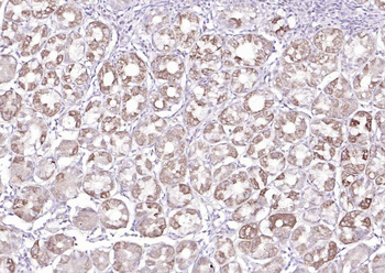 MUC5AC Rabbit Polyclonal Antibody