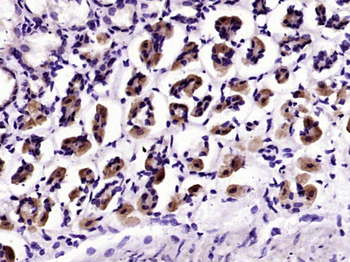 MUC5AC Rabbit Polyclonal Antibody