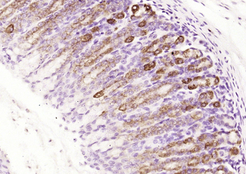 MUC5AC Rabbit Polyclonal Antibody