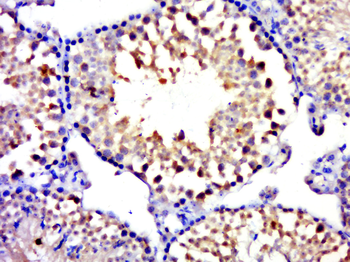 MYCBPAP Rabbit Polyclonal Antibody
