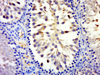 MYCBPAP Rabbit Polyclonal Antibody