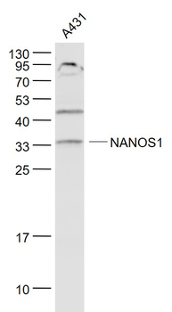 NANOS1 Rabbit Polyclonal Antibody