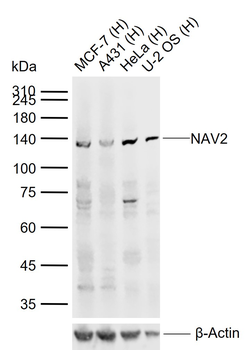 NAV2 Rabbit Polyclonal Antibody