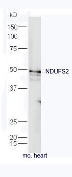 NDUFS2 Rabbit Polyclonal Antibody