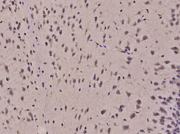 PCSK2/Proprotein Convertase 2 Rabbit Polyclonal Antibody