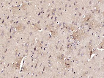 PCSK2/Proprotein Convertase 2 Rabbit Polyclonal Antibody