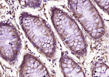 Phospho-NLK (Thr298) Rabbit Polyclonal Antibody