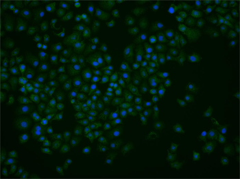 NET1 Rabbit Polyclonal Antibody