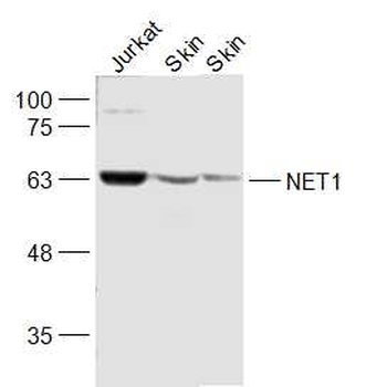 NET1 Rabbit Polyclonal Antibody