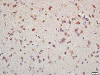 NET1 Rabbit Polyclonal Antibody