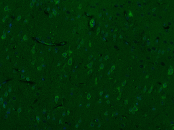 ChAT Rabbit Polyclonal Antibody (BF488)