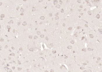Neurabin 1 Rabbit Polyclonal Antibody