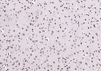 Neuro D Rabbit Polyclonal Antibody