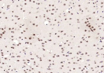 Neuro D Rabbit Polyclonal Antibody